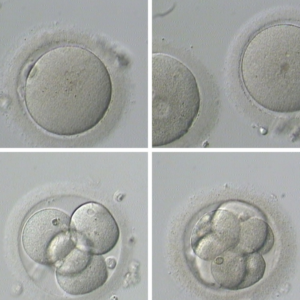 Frozen-Embryo-Transfer-process-Step-By-Step