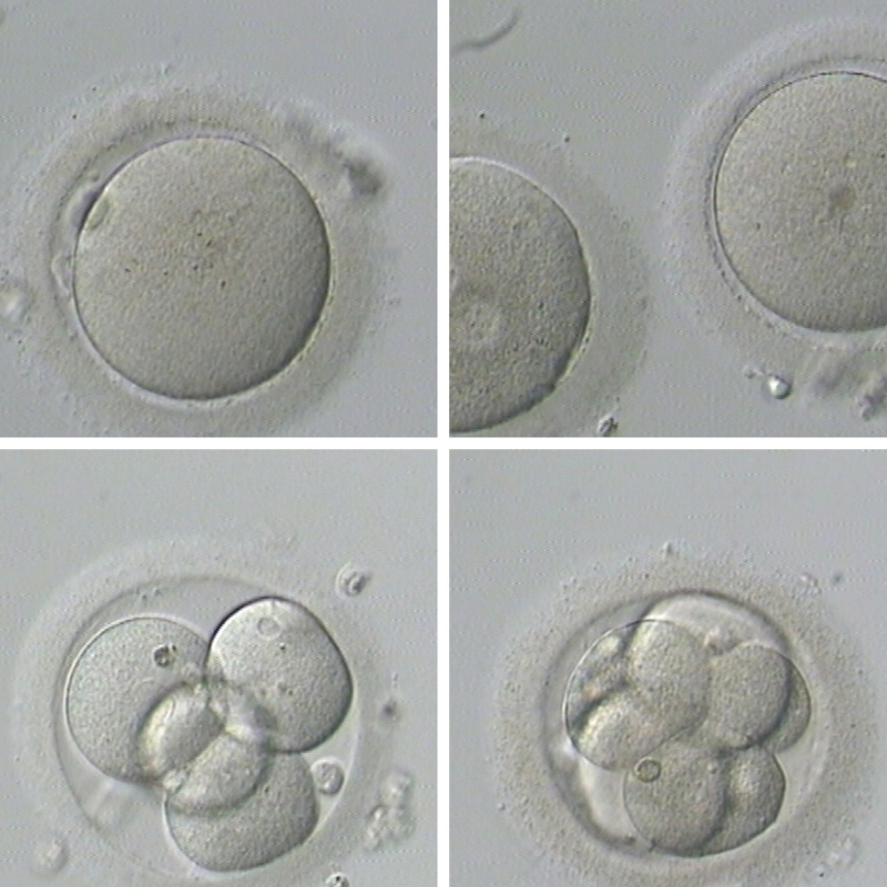 how-to-prepare-for-a-frozen-embryo-transfer-process-step-by-step